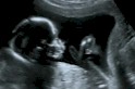 ultrascan