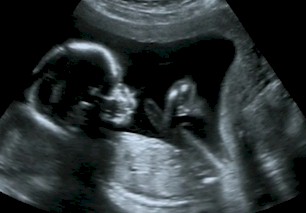 ultrascan
